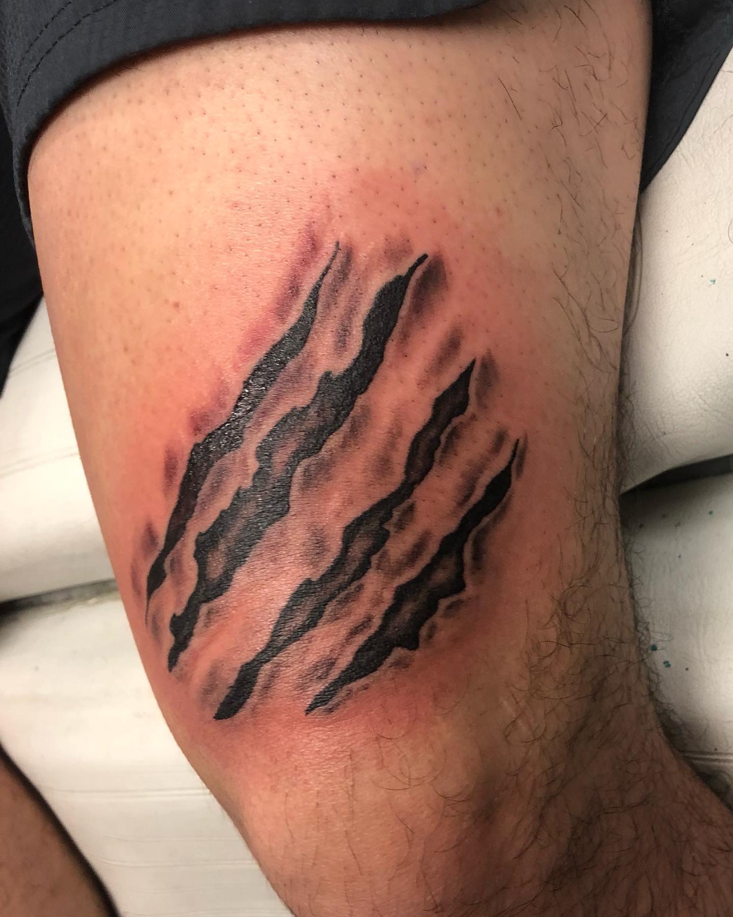 Cicatriz encima de tatuaje en la rodilla